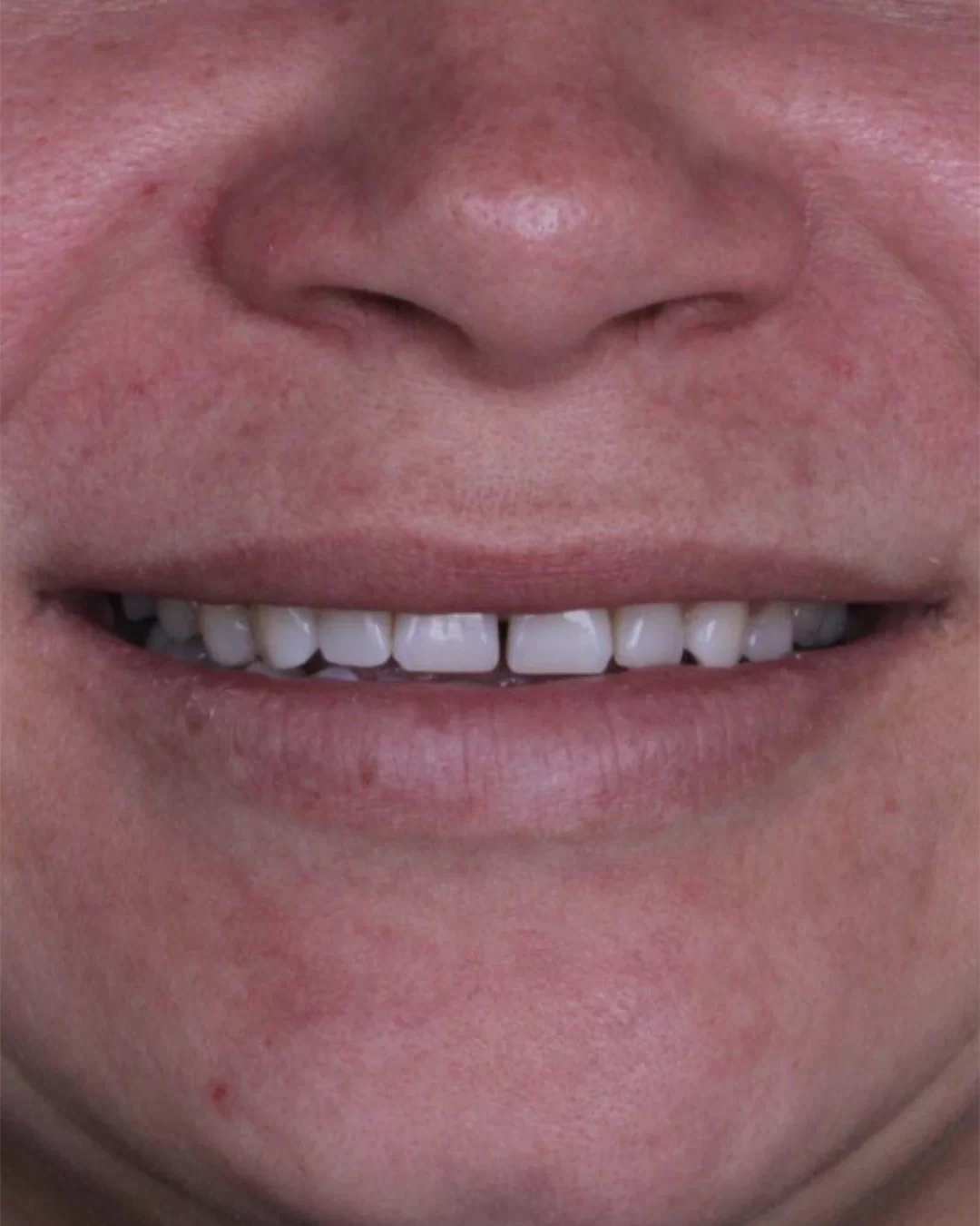 Reabilitação estética: antes do tratamento