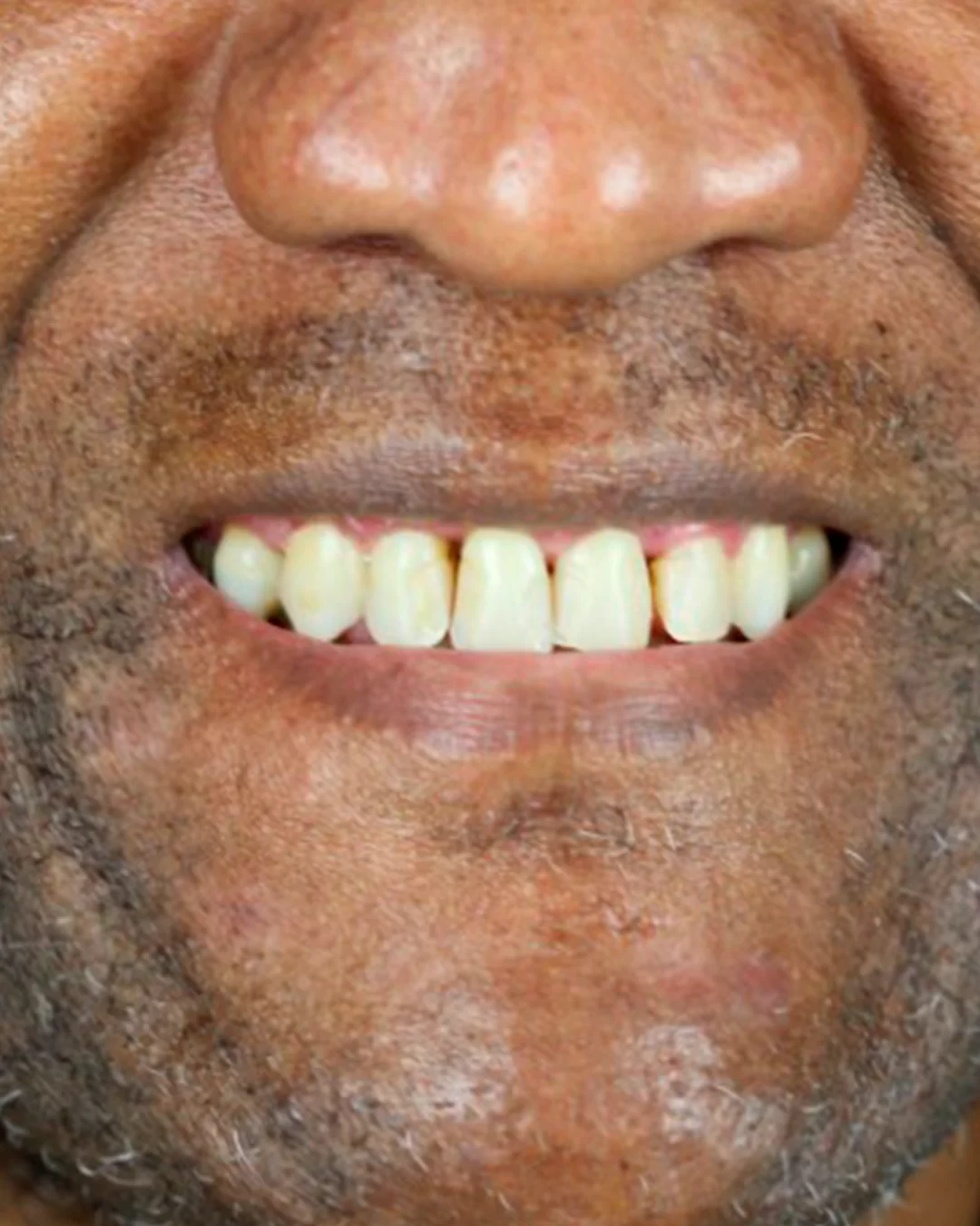 Harmonia do sorriso: antes do tratamento